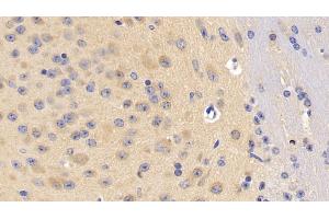 Detection of DLG4 in Mouse Cerebrum Tissue using Polyclonal Antibody to Discs, Large Homolog 4 (DLG4) (DLG4 抗体  (AA 1-393))