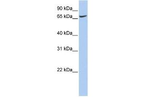 WB Suggested Anti-ATP6V0A1 Antibody Titration:  0.