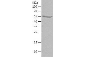 Western Blotting (WB) image for IKAROS Family Zinc Finger 1 (Ikaros) (IKZF1) (AA 1-519) protein (His tag) (ABIN7123400) (IKZF1 Protein (AA 1-519) (His tag))