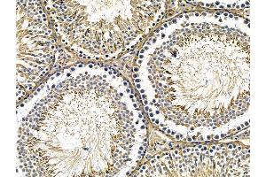 ABIN7096713 and ABIN7100778 at 1/100 staining rat testis tissue by IHC-P. (CHRNE 抗体)