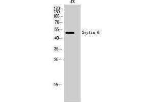 Western Blotting (WB) image for anti-Septin 6 (SEPT6) (Internal Region) antibody (ABIN3177370) (Septin 6 抗体  (Internal Region))