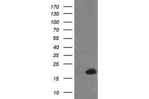 Western Blotting (WB) image for anti-Destrin (Actin Depolymerizing Factor) (DSTN) antibody (ABIN1497910) (Destrin 抗体)