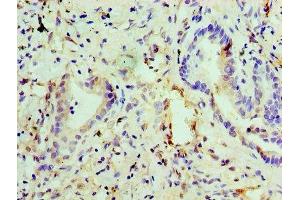 Immunohistochemistry of paraffin-embedded human lung tissue using ABIN7151444 at dilution of 1:100 (PHD1 抗体  (AA 283-407))