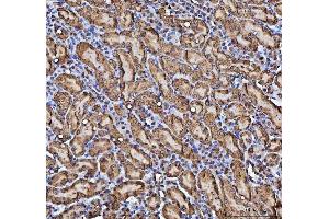 IHC analysis of CBR1 using anti-CBR1 antibody (ABIN7600015). (CBR1 抗体  (AA 14-262))