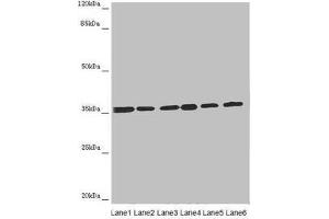 Western blot All lanes: ETFA antibody at 4. (ETFA 抗体  (AA 1-333))