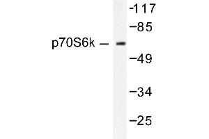 Image no. 1 for anti-Ribosomal Protein S6 Kinase, 70kDa, Polypeptide 1 (RPS6KB1) antibody (ABIN271771) (RPS6KB1 抗体)