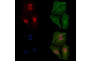 ABIN7094385 and ABIN7098432 staining  cells by IF/ICC. (NDOR1 抗体  (N-Term))