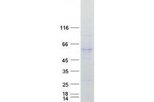 Western Blotting (WB) image for Glycerol Kinase (GK) (Transcript Variant 2) protein (Myc-DYKDDDDK Tag) (ABIN2722034)