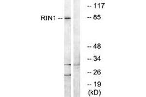 Western blot analysis of extracts from K562 cells, using RIN1 Antibody. (RIN1 抗体  (AA 655-704))