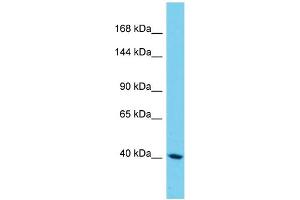 Western Blotting (WB) image for anti-Sterile alpha Motif Domain Containing 9-Like (SAMD9L) (N-Term) antibody (ABIN2790581) (SAMD9L 抗体  (N-Term))