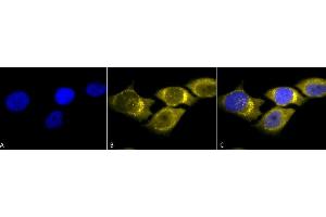 Immunocytochemistry/Immunofluorescence analysis using Rabbit Anti-SOD (Mn) Polyclonal Antibody (ABIN361655 and ABIN361656). (SOD2 抗体)