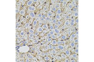 Immunohistochemistry of paraffin-embedded mouse liver using PCSK9 antibody.