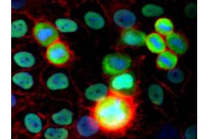 Immunofluorescence staining (human cervix carcinoma cells) Immunofluorescence staining of HeLa human cervix carcinoma cell line using purified anti-Ku Antigen (MEM-54) (detection by Goat anti-mouse IgG2a Alexa Fluor ® 488; green). (X-Ray Repair Cross Complementing 5 抗体)