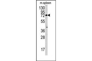 Image no. 1 for anti-Mannosyl (Beta-1,4-)-Glycoprotein beta-1,4-N-Acetylglucosaminyltransferase (MGAT3) (N-Term) antibody (ABIN357703) (MGAT3 抗体  (N-Term))