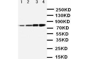 Anti-PI 3 Kinase p85 alpha antibody, Western blotting Lane 1: MCF-7 Cell Lysate Lane 2: HELA Cell Lysate Lane 3: COLO Cell Lysate Lane 4: SW620 Cell Lysate (PIK3R1 抗体  (N-Term))