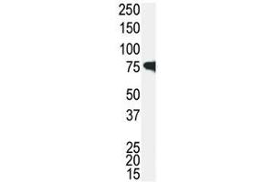 Western blot analysis of IRAK antibody and Jurkat cell lysate. (IRAK1 抗体  (AA 683-712))