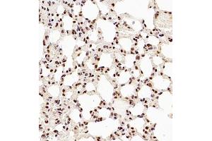 Immunohistochemistry (Paraffin-embedded Sections) (IHC (p)) image for anti-NSFL1 (p97) Cofactor (p47) (NSFL1C) antibody (ABIN7074865)