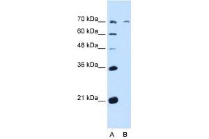 GALNT6 antibody used at 5 ug/ml to detect target protein. (GALNT6 抗体  (N-Term))