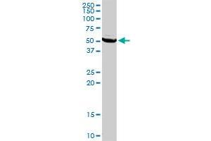 TYMP MaxPab rabbit polyclonal antibody. (Thymidine Phosphorylase 抗体  (AA 1-482))