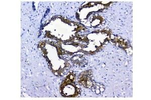 IHC analysis of NMI using anti-NMI antibody (ABIN3043451).