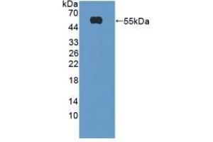 Detection of Recombinant TREM2, Mouse using Polyclonal Antibody to Triggering Receptor Expressed On Myeloid Cells 2 (TREM2) (TREM2 抗体  (AA 1-227))