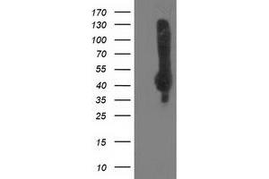 Western Blotting (WB) image for anti-Sialidase 2 (Cytosolic Sialidase) (NEU2) antibody (ABIN1499694) (NEU2 抗体)
