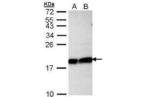 WB Image Sample (30 ug of whole cell lysate) A: Hela B: Hep G2 , 12% SDS PAGE antibody diluted at 1:1000