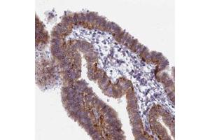Immunohistochemical staining of human fallopian tube with B9D2 polyclonal antibody  shows distinct positivity in ciliated cells.