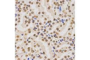 Immunohistochemistry (IHC) image for anti-Histone 3 (H3) (H3K36me2) antibody (ABIN3016036)