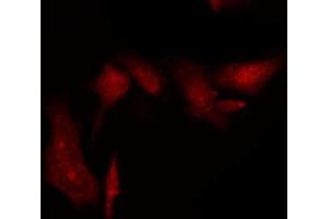ABIN6269395 staining HT29 by IF/ICC. (FANCD2 抗体  (N-Term))