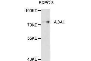 Western blot analysis of extracts of BxPC-3 cells, using AOAH antibody (ABIN5997236) at 1/1000 dilution. (AOAH 抗体)