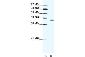 WB Suggested Anti-LDB2 Antibody Titration:  1. (LIM Domain Binding 2 Protein 抗体  (C-Term))