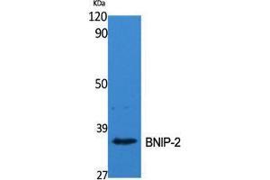 Western Blot (WB) analysis of specific cells using BNIP-2 Polyclonal Antibody.
