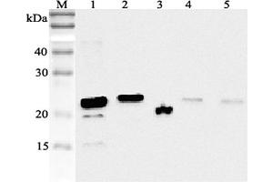 Western blot analysis using anti-RBP4 (human), pAb  at 1:2'000 dilution. (RBP4 抗体)