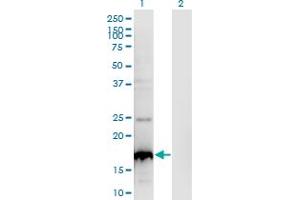 Western Blot analysis of BLOC1S2 expression in transfected 293T cell line by BLOC1S2 monoclonal antibody (M01), clone 8C10. (BLOC1S2 抗体  (AA 1-142))