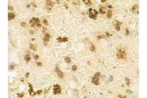 anti-Hairless (HR) antibody