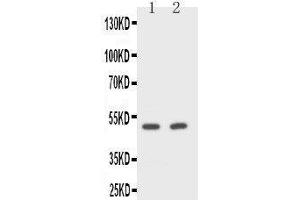 Anti-CD2 antibody, Western blotting Lane 1: Rat Spleen Cell Lysate Lane 2: NIH/3T3 Cell Lysate (CD2 抗体  (Middle Region))
