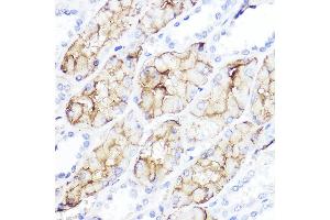 Immunohistochemistry (IHC) image for anti-Aquaporin 1 (Colton Blood Group) (AQP1) (C-Term) antibody (ABIN7265651)