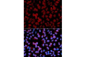 Immunofluorescence analysis of U2OS cell using TNFAIP3 antibody. (TNFAIP3 抗体)