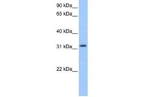 WB Suggested Anti-C14orf140 Antibody Titration: 0. (ZC2HC1C 抗体  (N-Term))