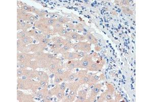 Immunohistochemistry of paraffin-embedded Human liver using DBH Polyclonal Antibody at dilution of 1:200 (40x lens). (DBH 抗体)