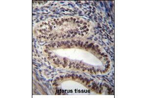 PGR/PR Antibody (Center) (ABIN656981 and ABIN2846164) immunohistochemistry analysis in formalin fixed and paraffin embedded human uterus tissue followed by peroxidase conjugation of the secondary antibody and DAB staining. (Progesterone Receptor 抗体  (AA 349-377))