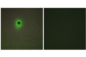 Immunofluorescence analysis of A549 cells, using HIPK4 antibody. (HIPK4 抗体  (C-Term))