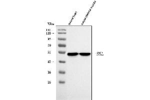 Western blot analysis of Sarcalumenin/Srl using anti-Sarcalumenin/Srl antibody (ABIN7599804).