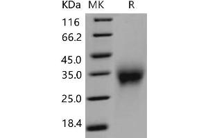 Western Blotting (WB) image for Activin RIIA / ACVR2A (Active) protein (His tag) (ABIN7194139) (Activin RIIA / ACVR2A (Active) protein (His tag))