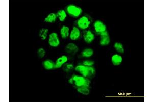 Immunofluorescence of monoclonal antibody to FOXA1 on A-431 cell. (FOXA1 抗体  (AA 367-472))