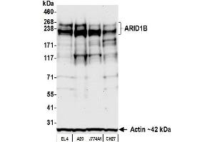 anti-AT Rich Interactive Domain 1B (SWI1-Like) (ARID1B) (AA 1425-1475) antibody