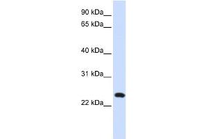 WB Suggested Anti-C20orf103 Antibody Titration:  0. (LAMP5 抗体  (Middle Region))