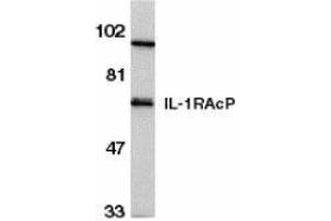 Western blot analysis of IL-1RAcP in HeLa whole cell lysate with AP30412PU-N IL-1RAcP antibody at 1/500 dilution. (FBXO43 抗体  (C-Term))