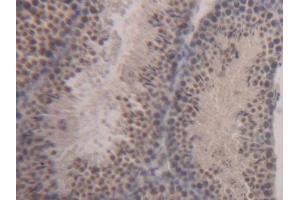 DAB staining on IHC-P; Samples: Mouse Testis Tissue (STAT1 抗体  (AA 432-680))